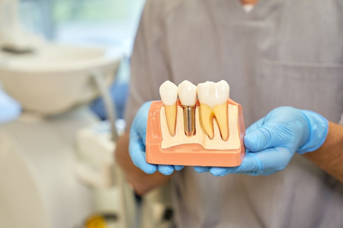 Dental Implant Consultation Dentist holding dental implant model showing tooth replacement procedure in Duxbury.