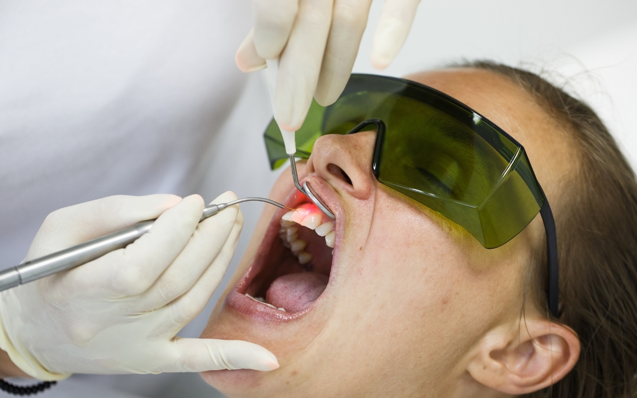 Smile Design: How Dentists Use Technology To Improve Appearance Dentist using laser technology and protective eyewear to perform cosmetic dental treatment on patient's teeth.