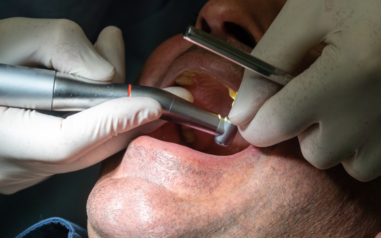 Can Dental Implants Be Used for a Full Mouth Restoration Dentist using intraoral camera to examine patient's teeth during full mouth dental implant consultation.