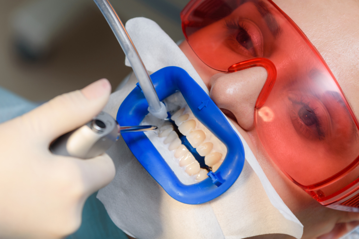 Common Causes of TMJ Disorders Stress, Teeth Grinding, Injury, and More Dental shade guide being used to match tooth color during cosmetic dental treatment.