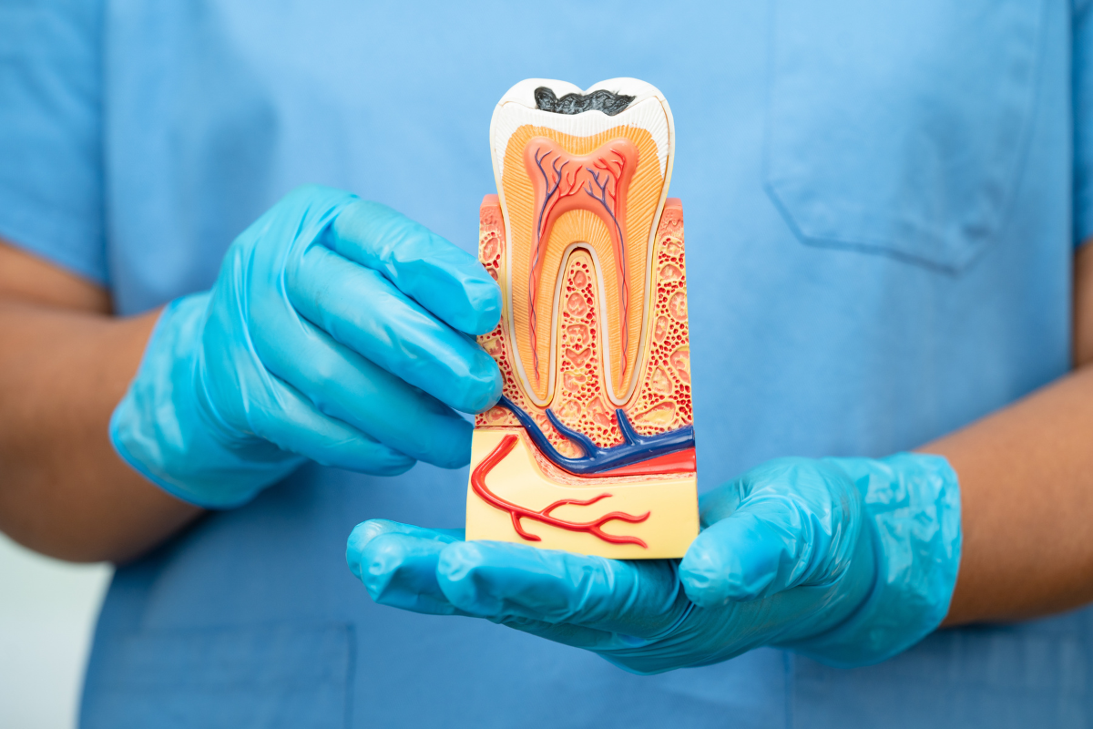 Dental professional holding anatomical tooth model showing internal structure and blood vessels for implant education.