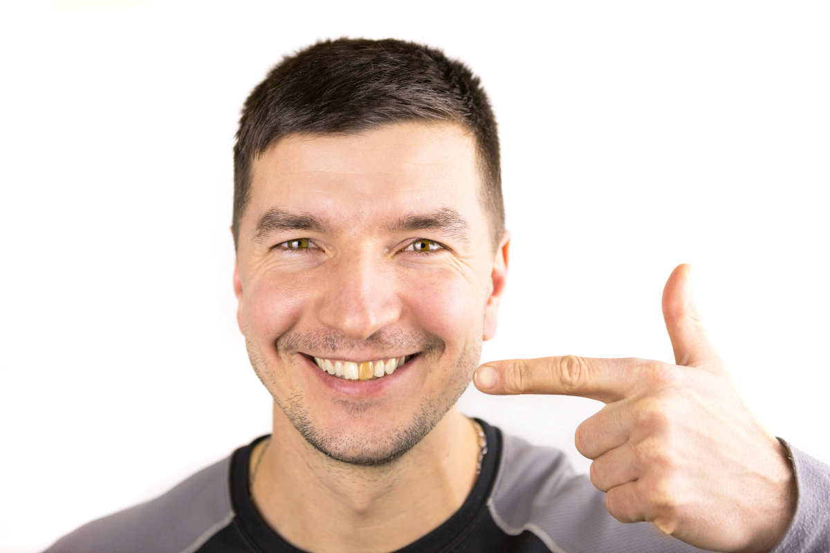 Common Mistakes That Can Shorten the Lifespan of Cosmetic Dental Work Man smiling and pointing at camera, demonstrating a healthy bright smile.