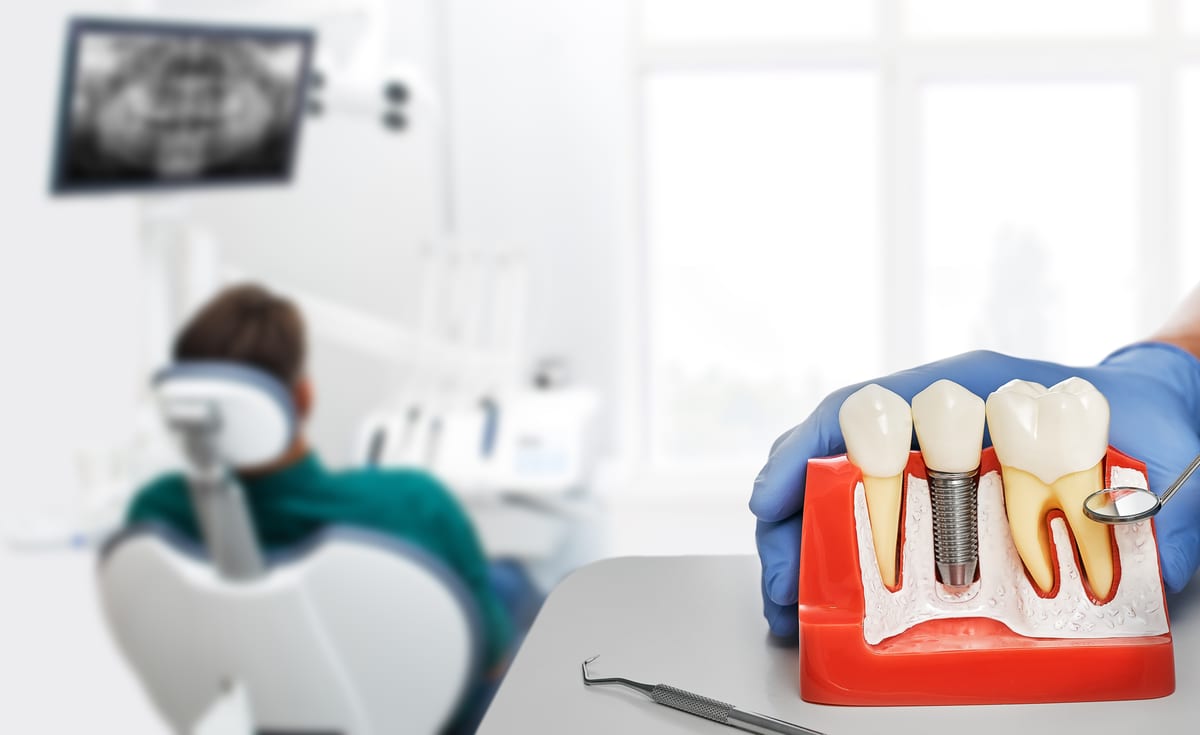 Dental Bridges in Duxbury Dental Bridges in Duxbury